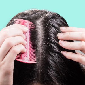 نقش سلامت پوست سر در داشتن موهای قوی تر